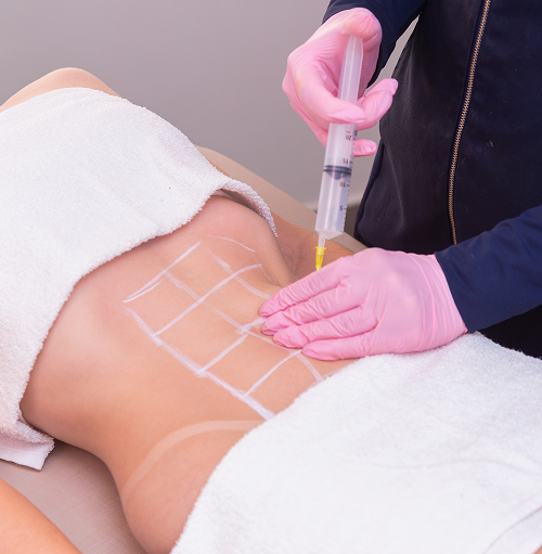 doctor injecting woman's belly