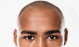 close-up of a man’s forehead