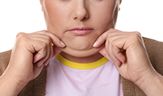 woman with double chin